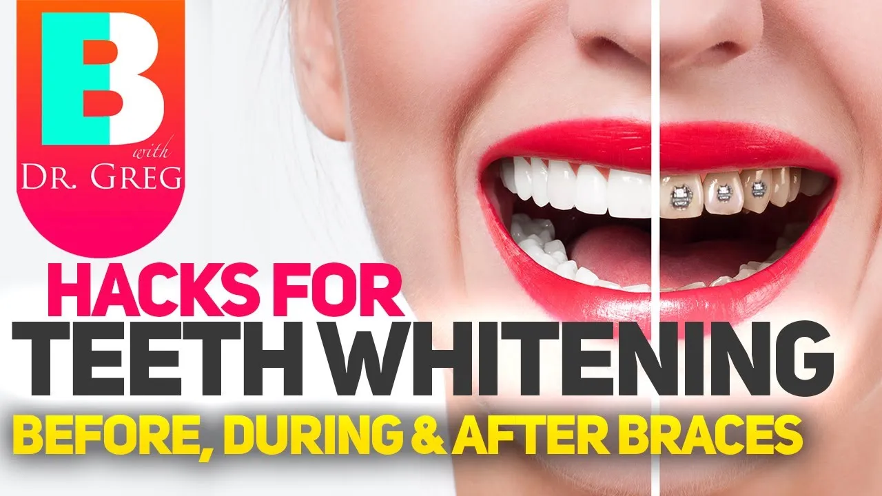 30016 uneven whitening