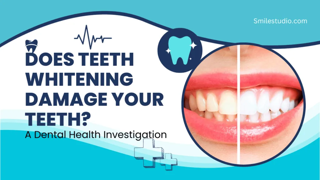 30017 tooth whitening procedures