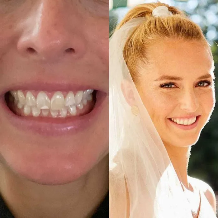 30019 bright smile wedding