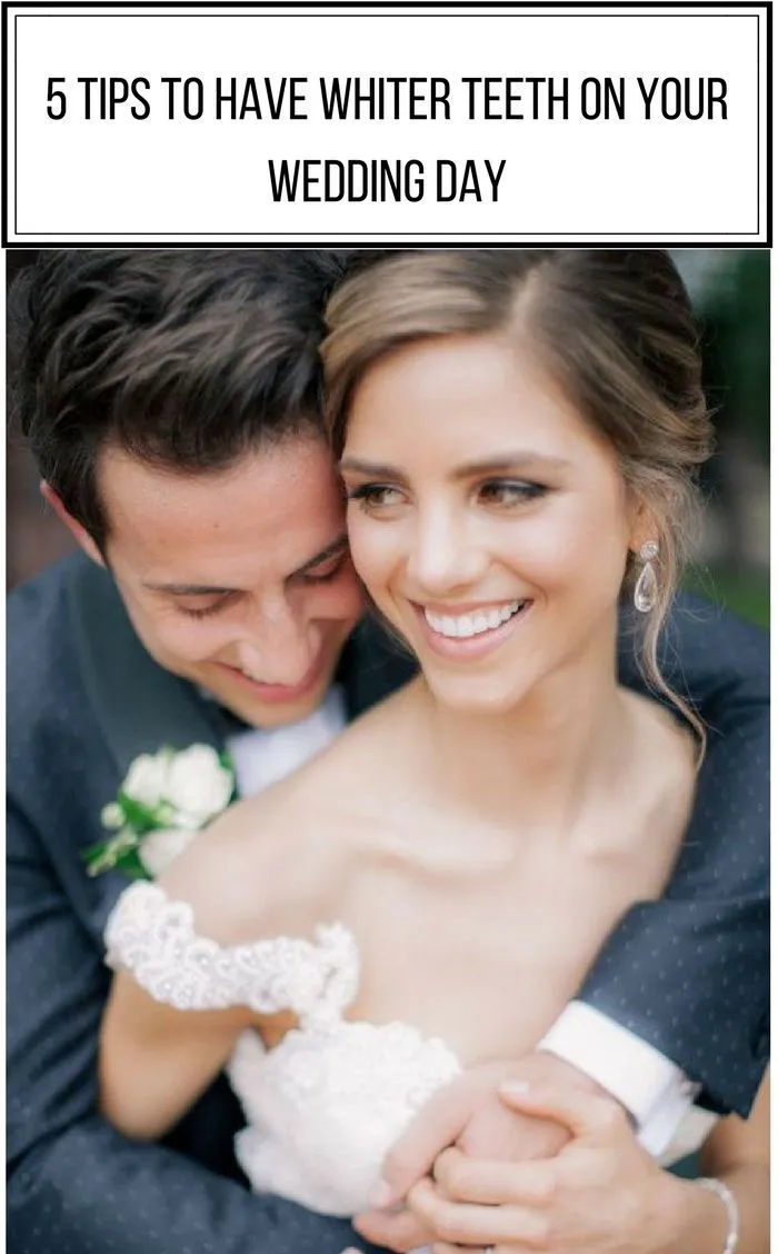 30019 in office teeth whitening