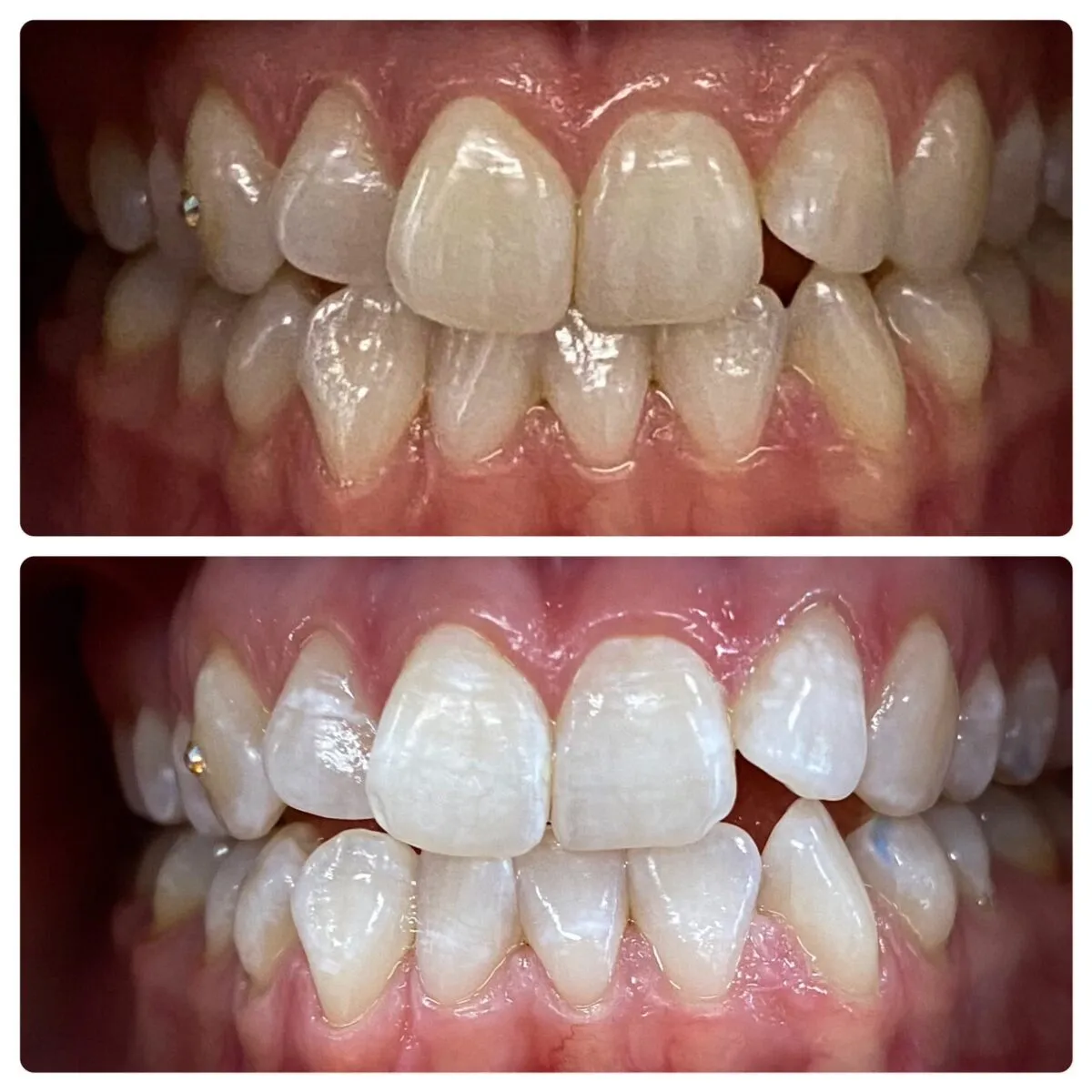 30023 whitening toothpaste strips