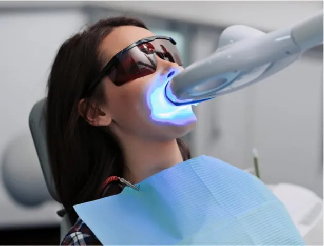 30024 teeth whitening elk grove 4