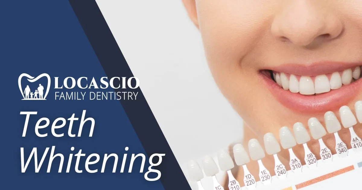 30024 teeth whitening elk grove 7