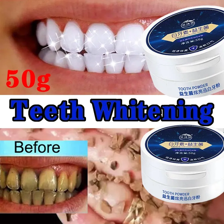 30026 teeth stain removal