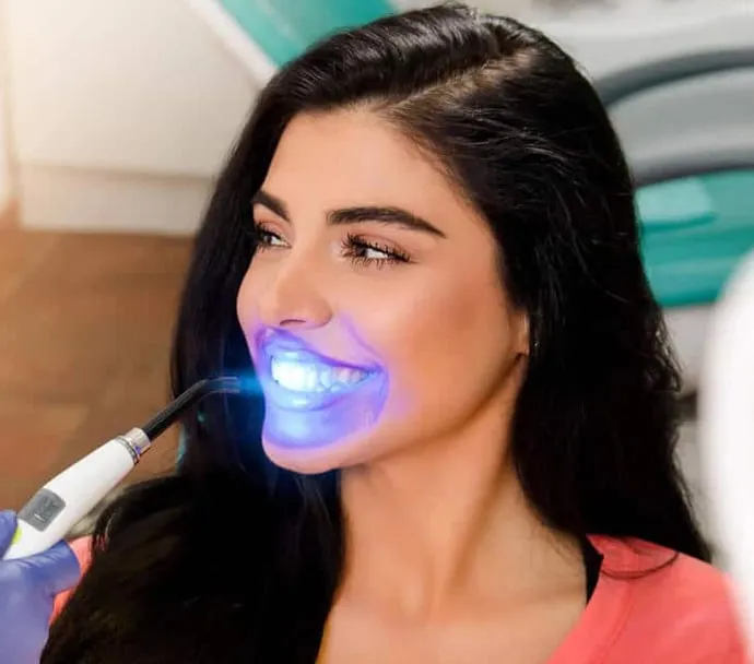 30028 affordable teeth whitening