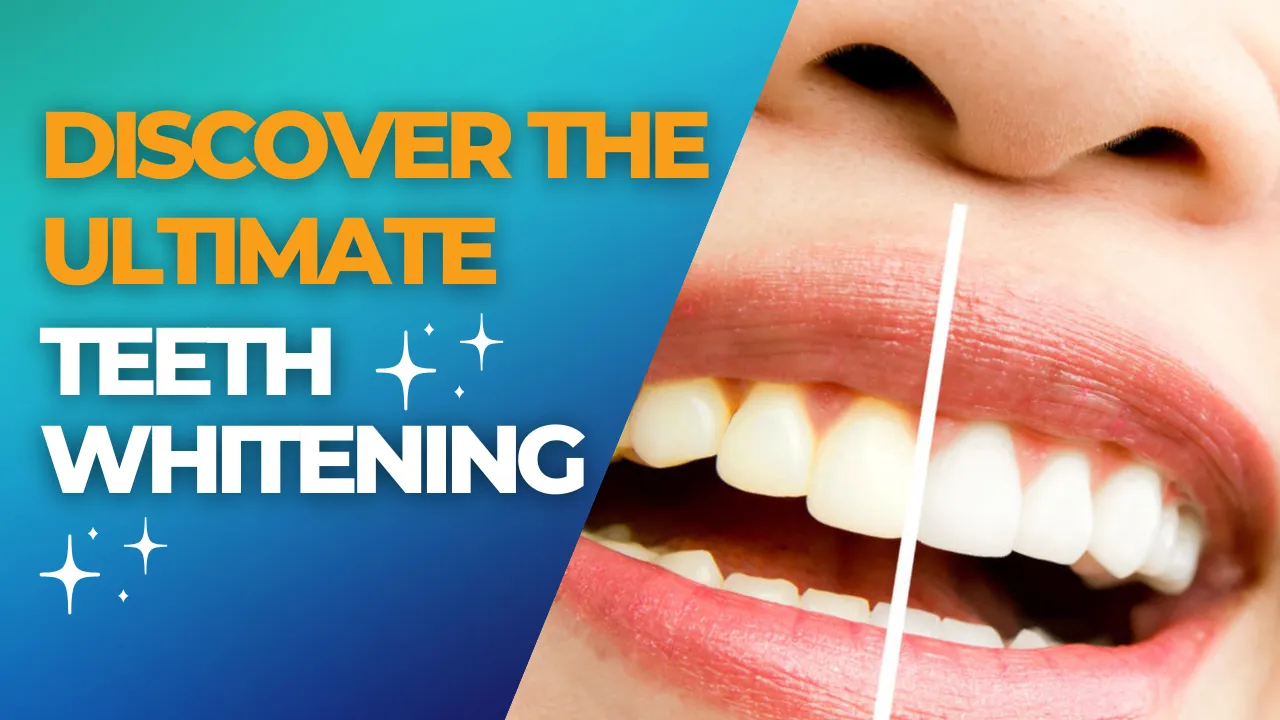 30029 maintaining white teeth