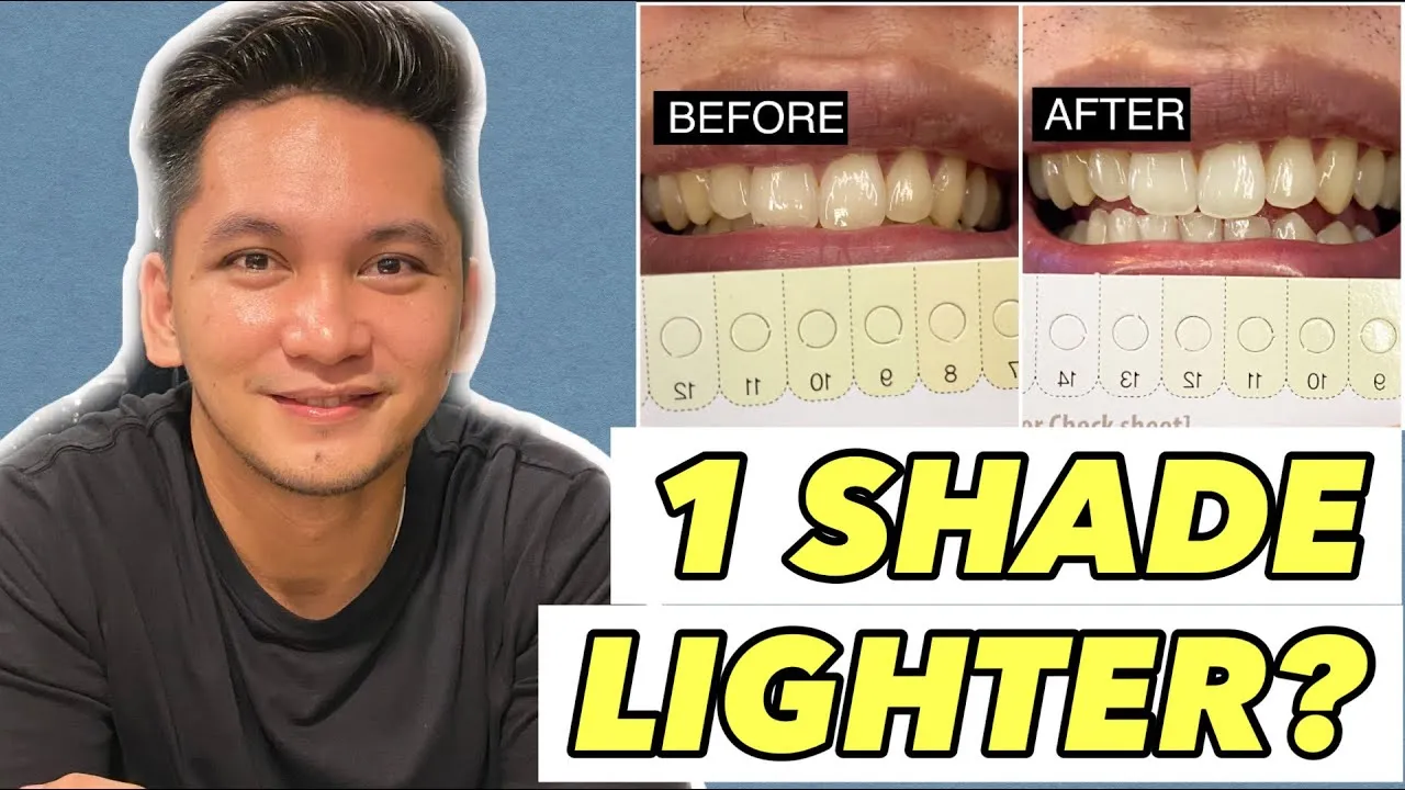 30029 teeth whitening science