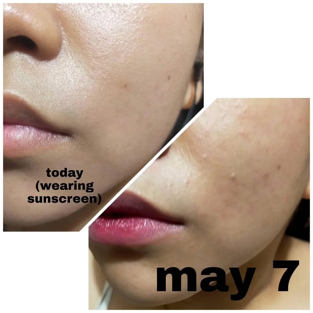 30033 minimize sun damage