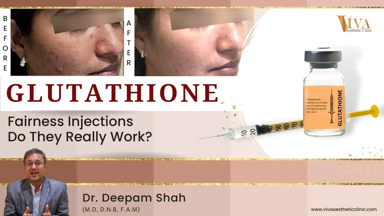 30034 glutathione injection lifestyle