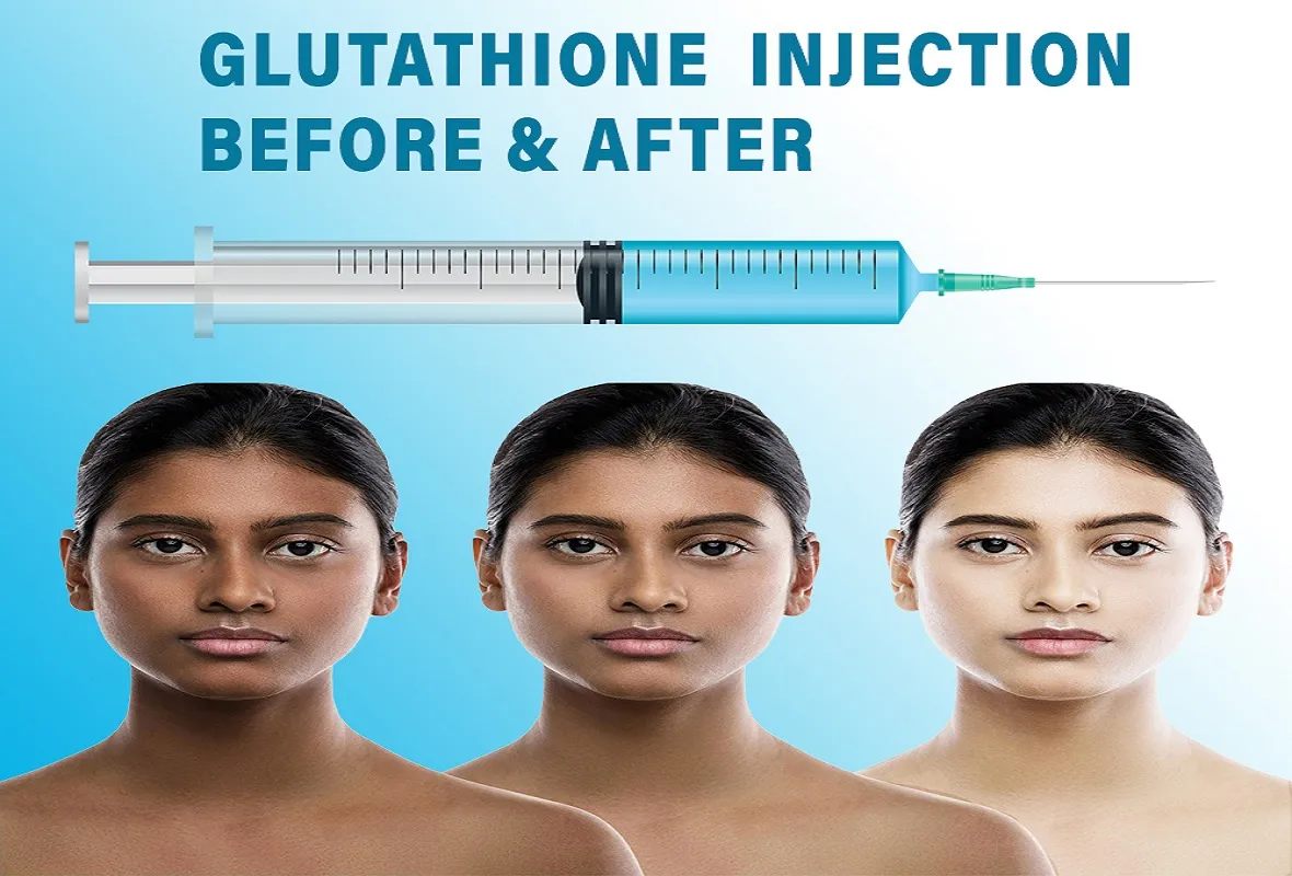 30034 glutathione injection side effects