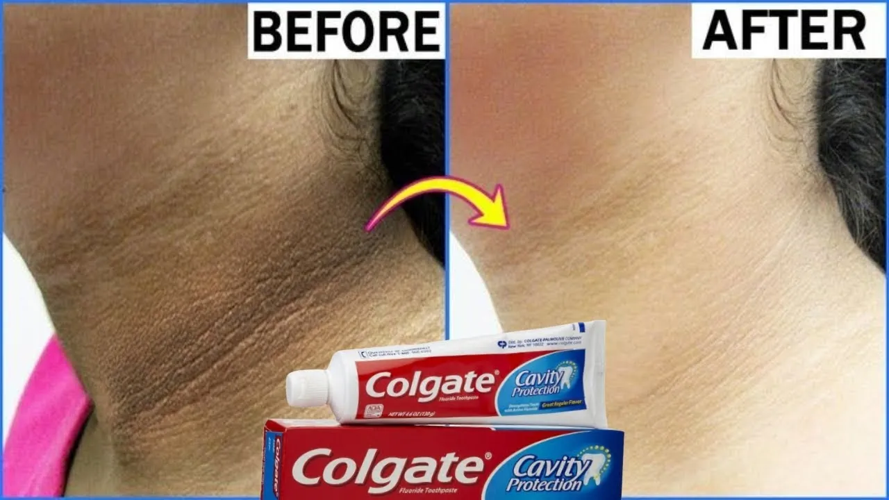 30035 whitening creams