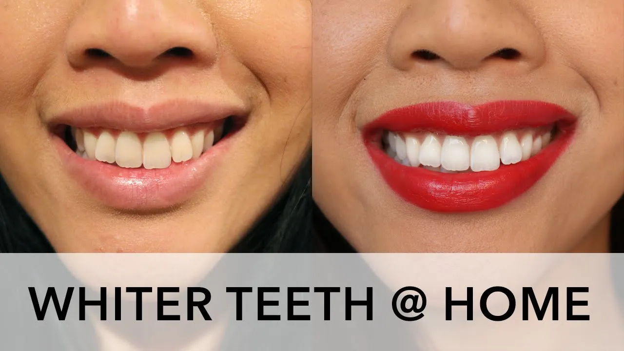 30037 whitewithstyle kit