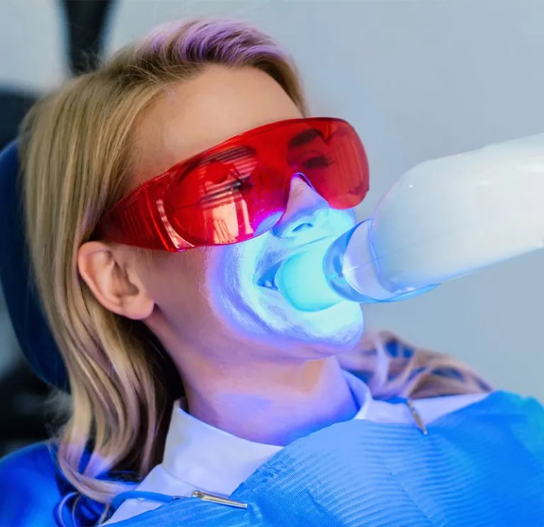 30039 teeth whitening birmingham al 3