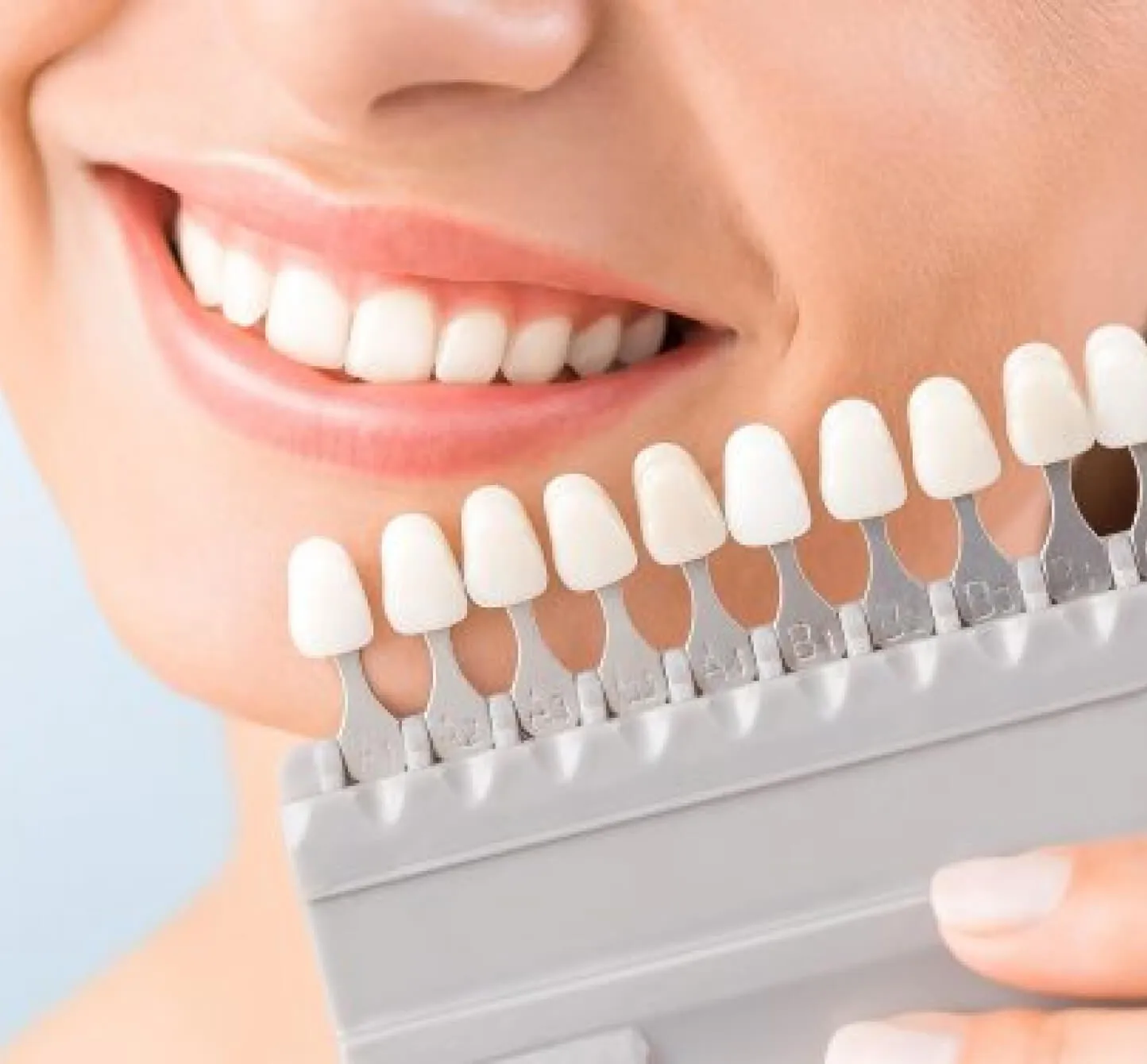 30039 teeth whitening birmingham al 5