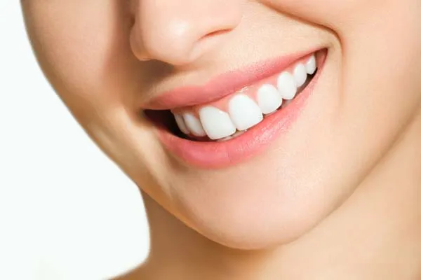 30040 sioux falls teeth whitening procedure