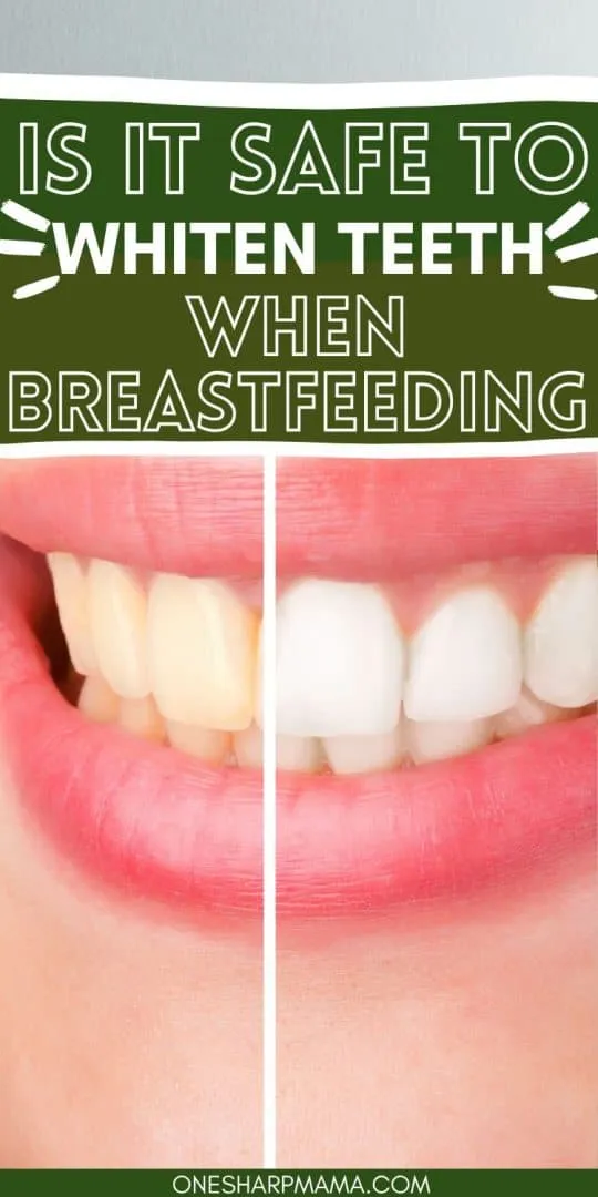 30052 teeth whitening breastfeeding main