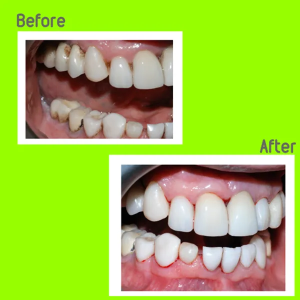 30053 herbal tea whitening