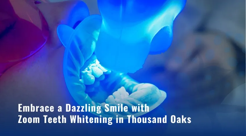 30055 brite whitening thousand oaks dental hygiene