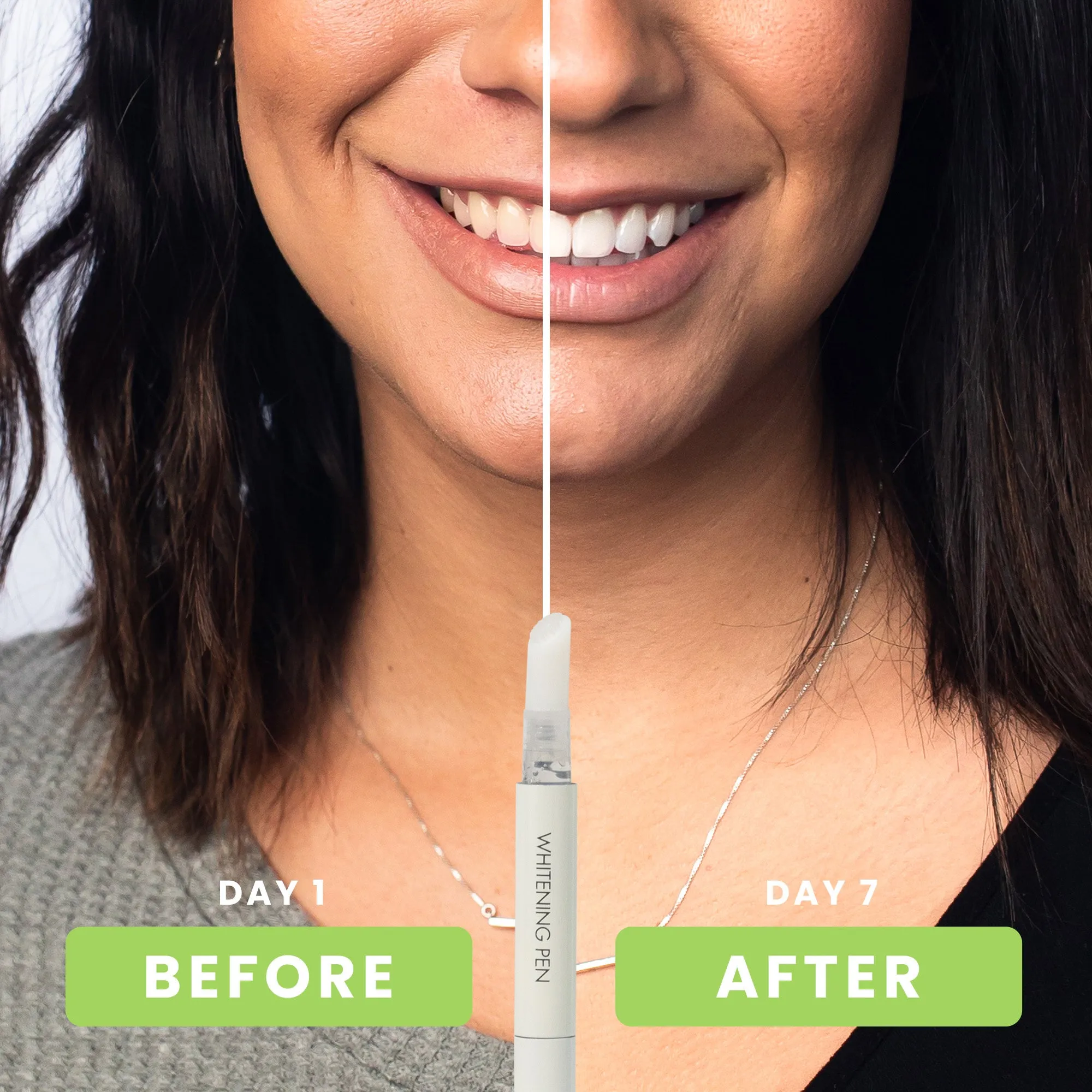 30055 brite whitening thousand oaks professional treatment