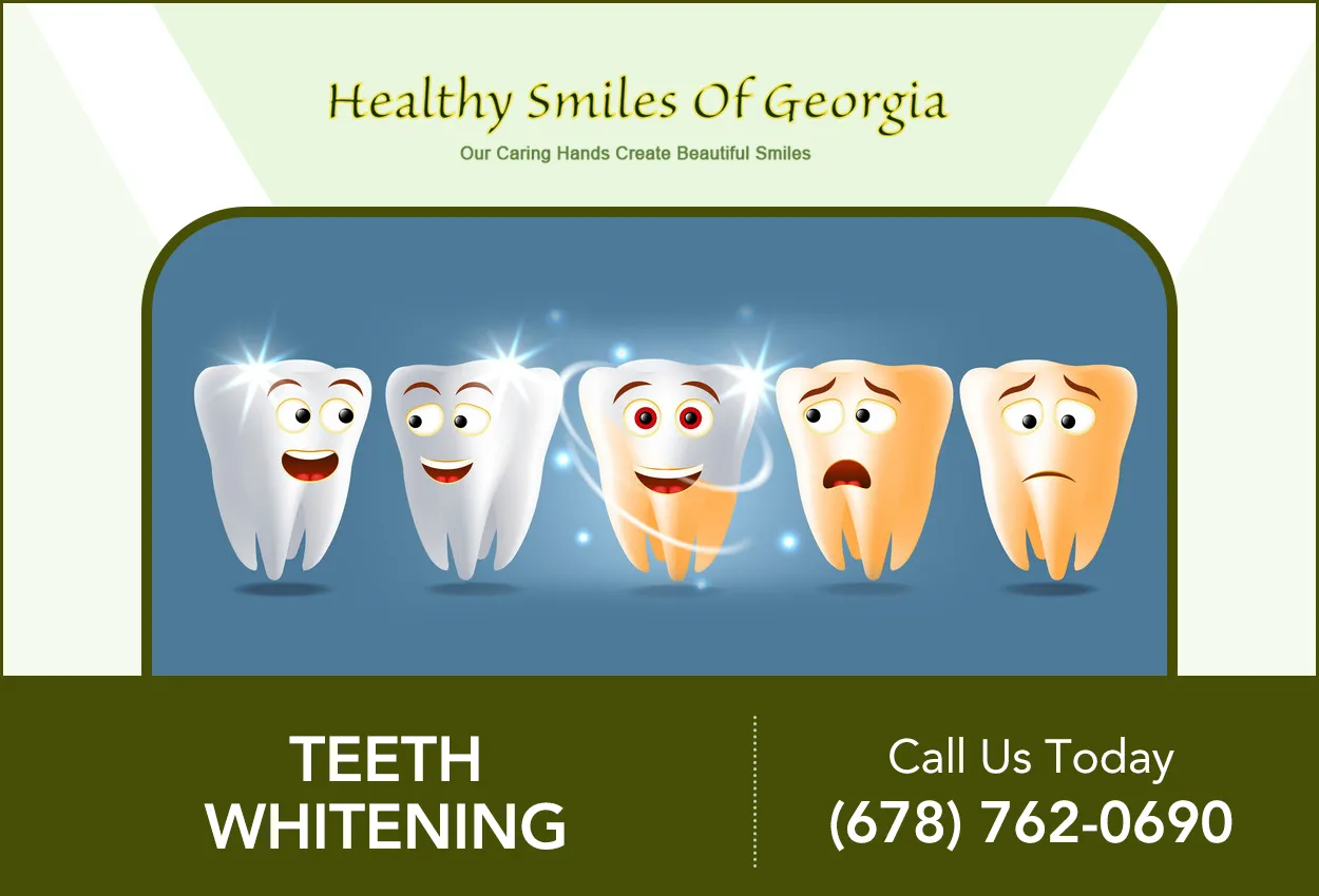 /img/30062-teeth-whitening-maintenance.webp