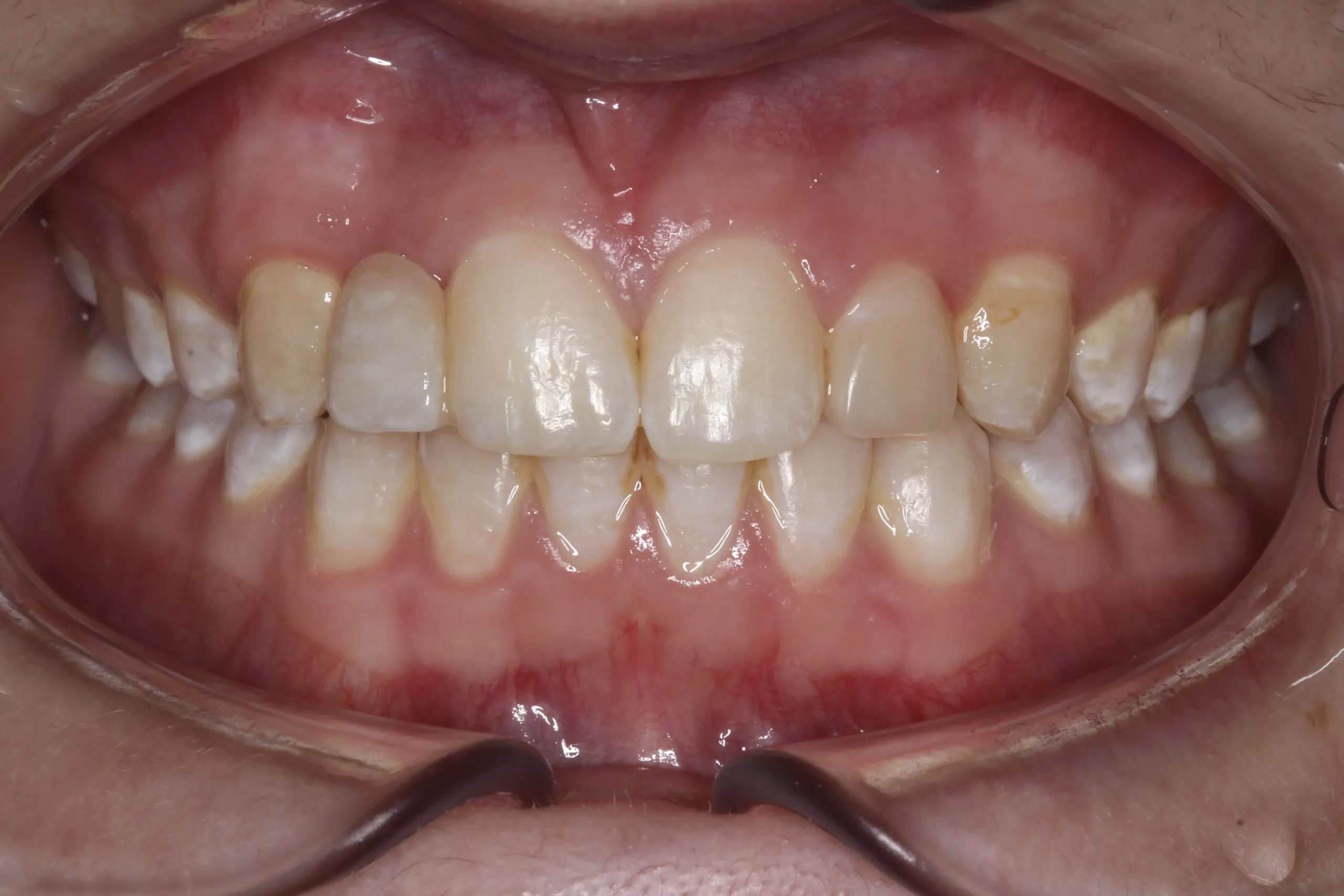 /img/30063-dental-checkup.webp
