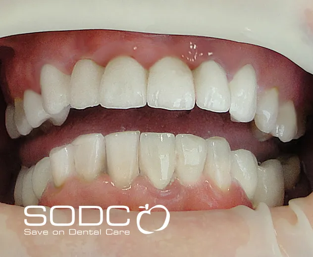 30063 whitening toothpaste