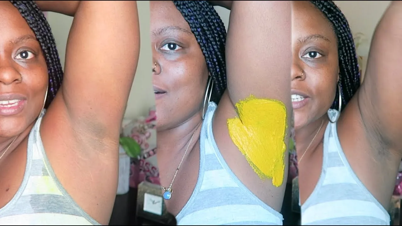 30075 antibacterial turmeric