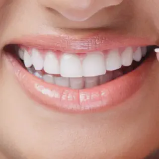 /img/30080-whitening-toothpaste.webp