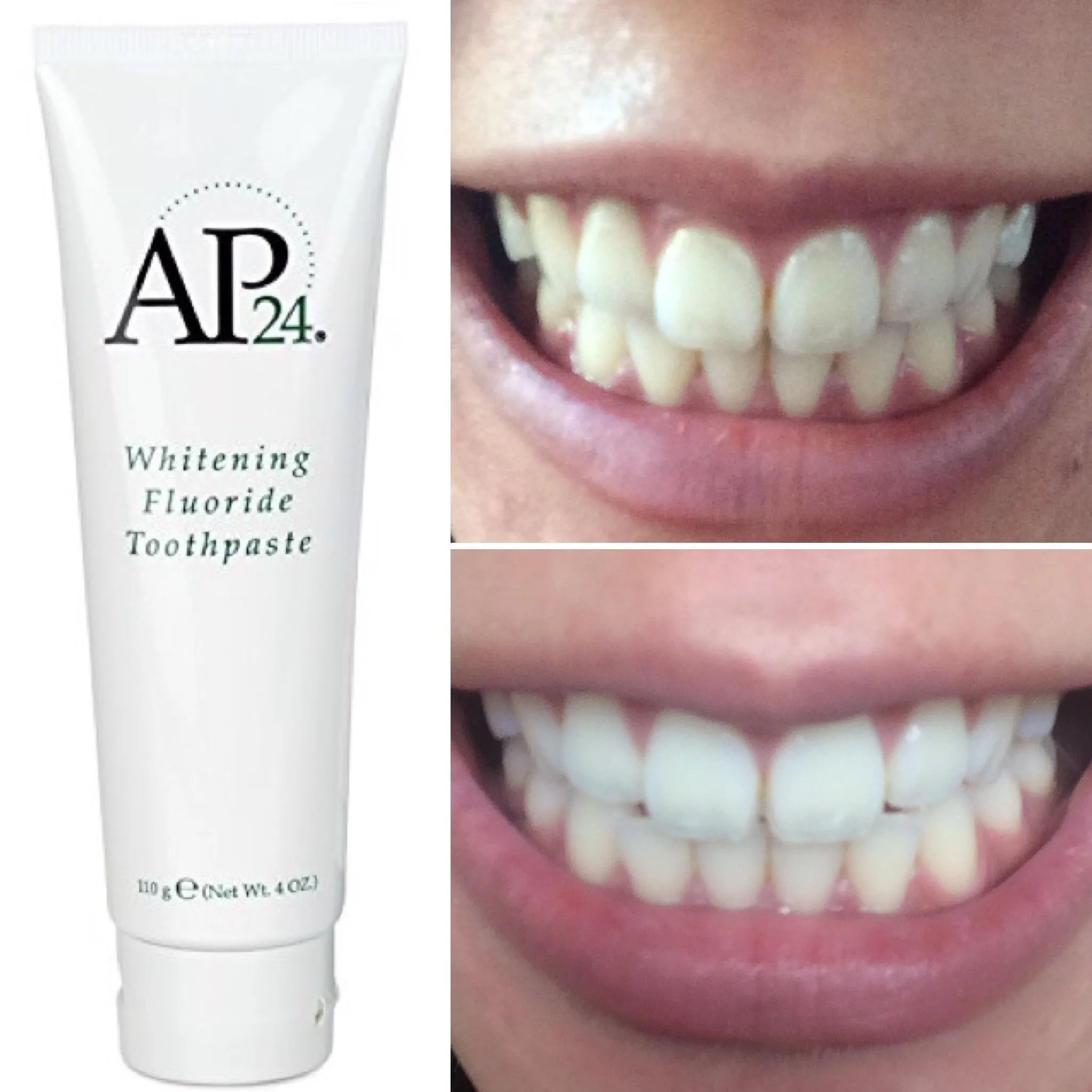30082 teeth whitening