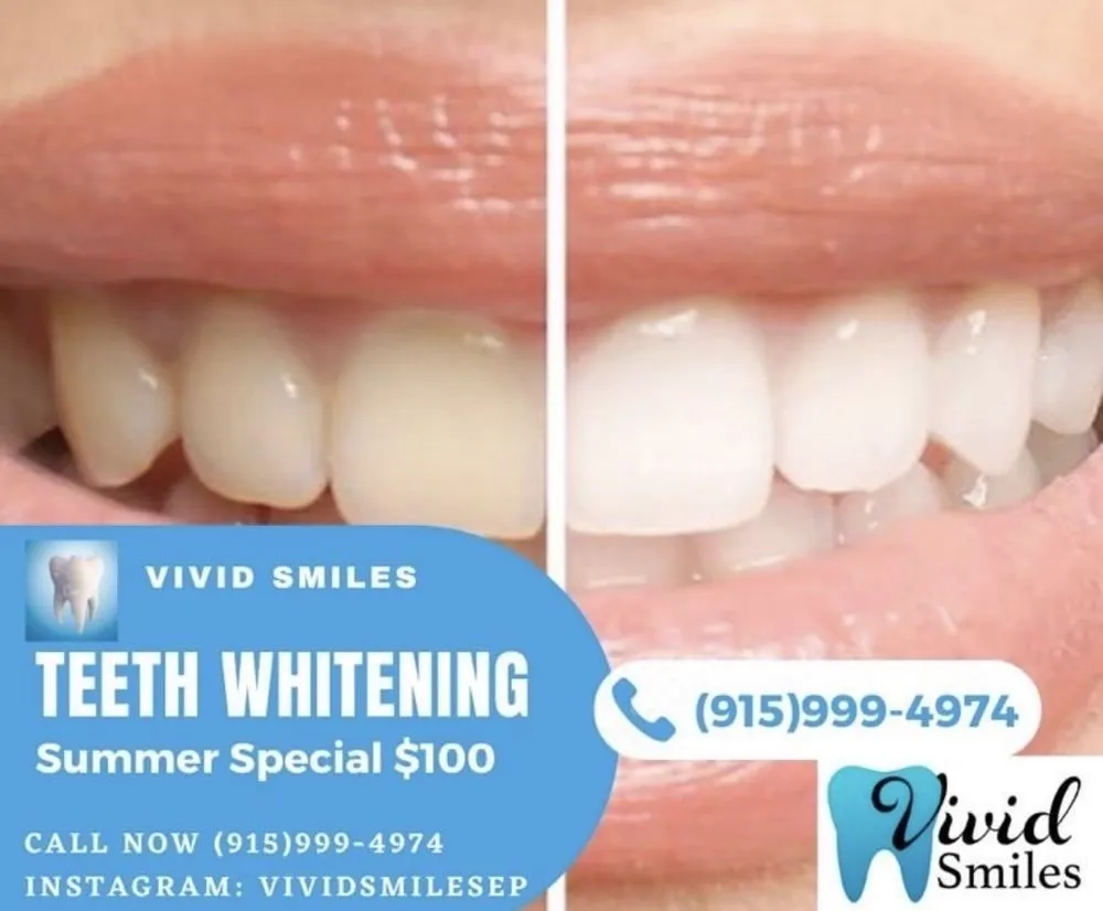 30085 teeth whitening el paso tx main