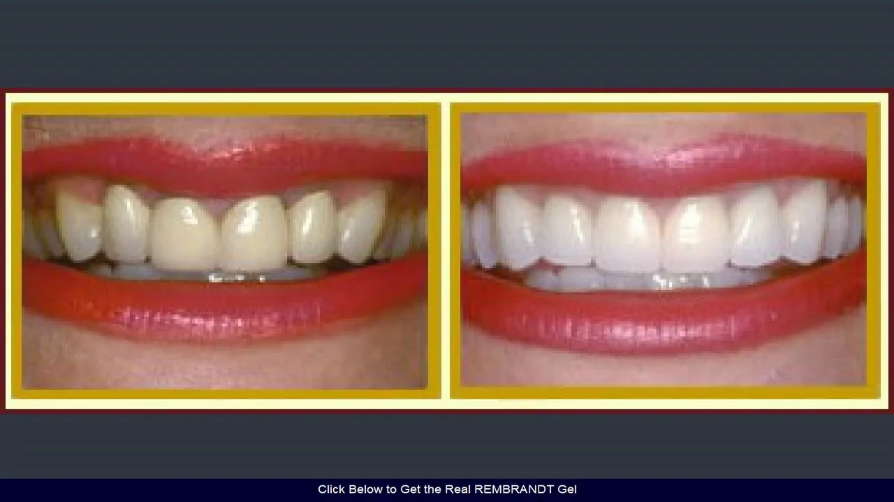 30094 teeth whitening application