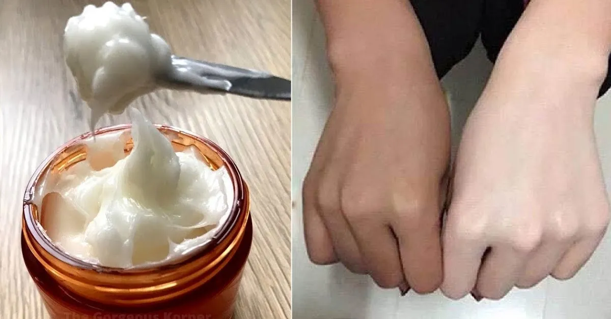 30095 diy skin whitening cream ingredients