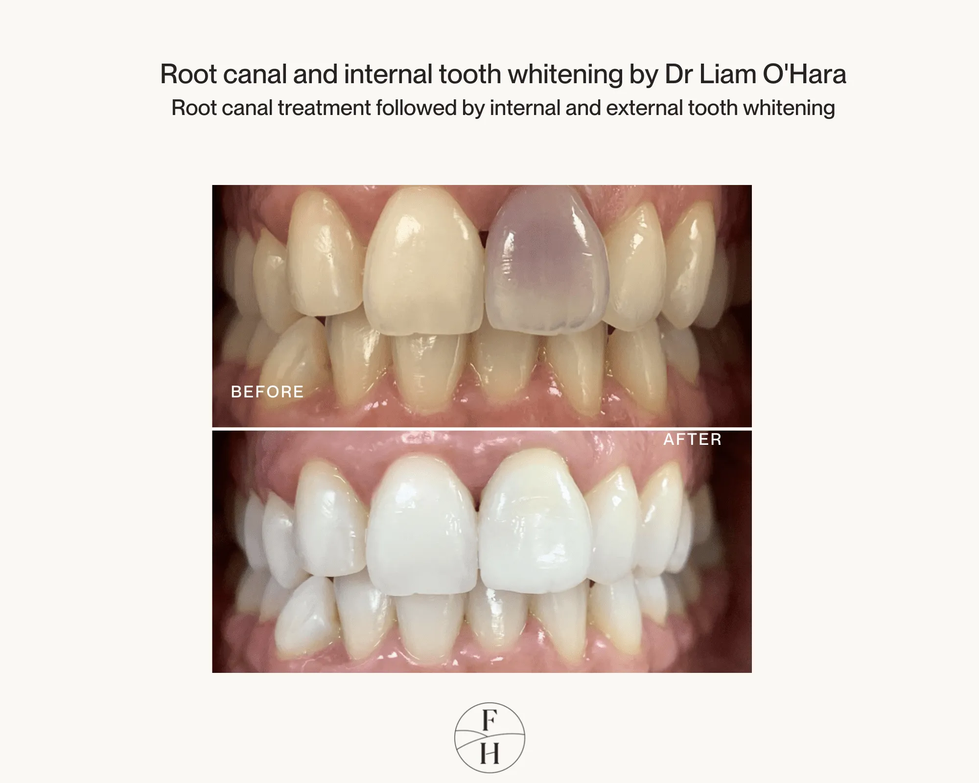 30096 dentist consultation