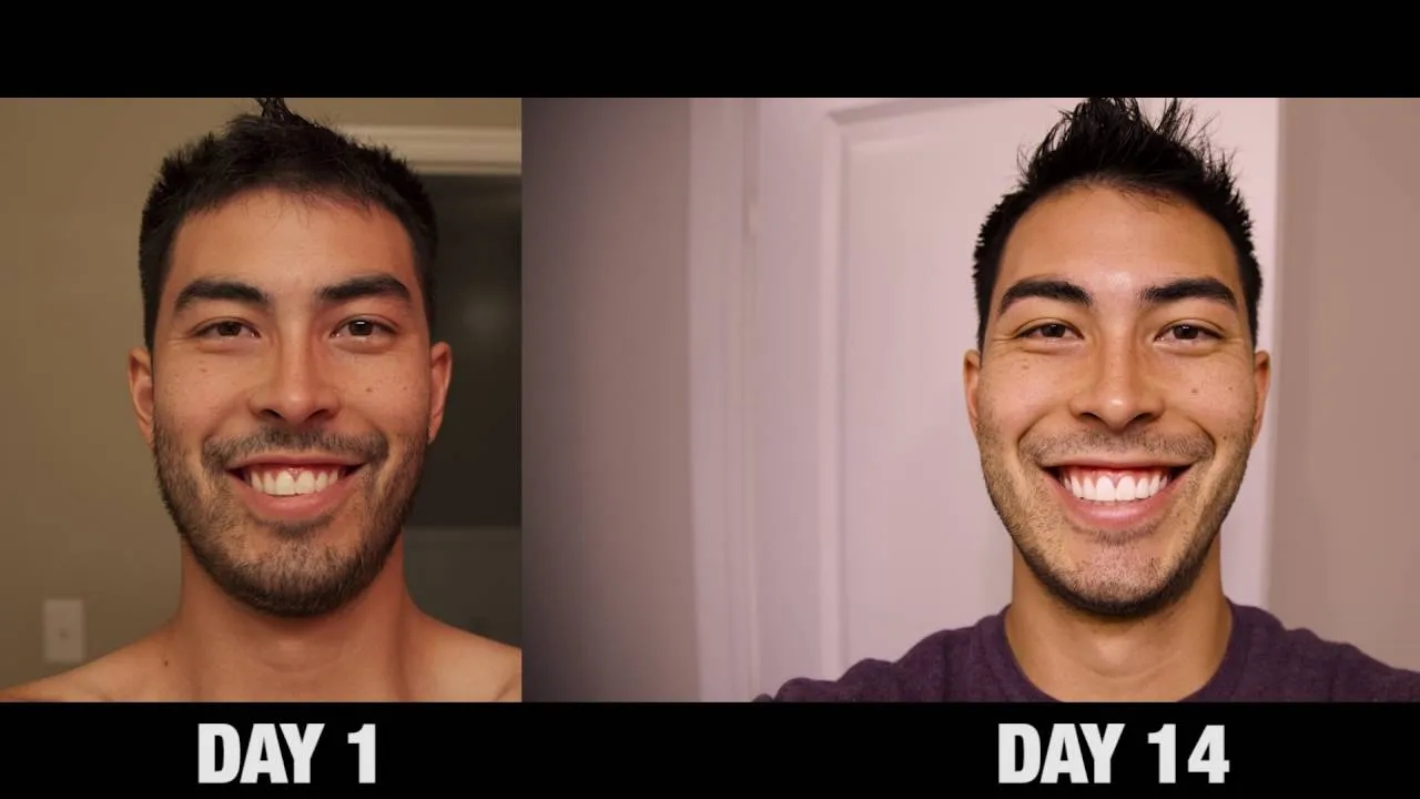 30102 crest vs other toothpastes