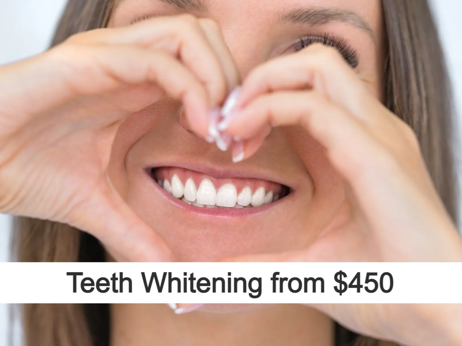 30108 otc teeth whitening