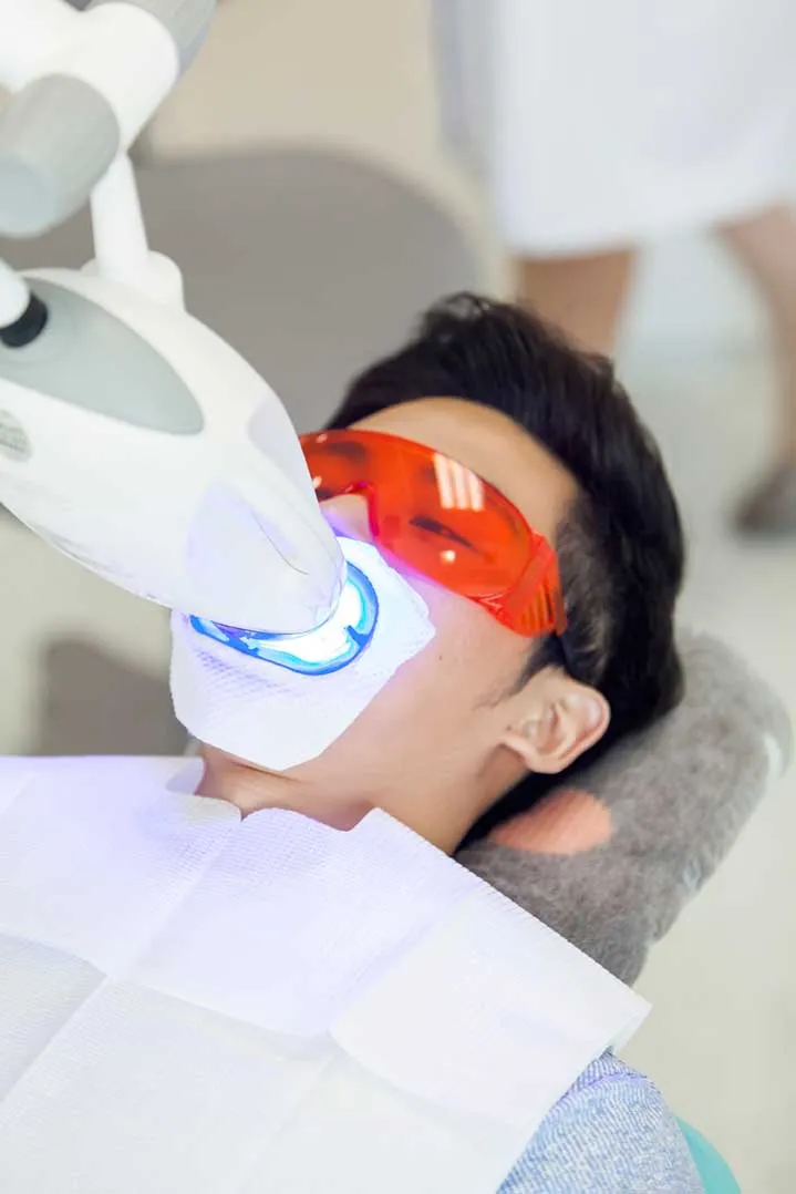 30113 zoom teeth whitening memphis tn food stains