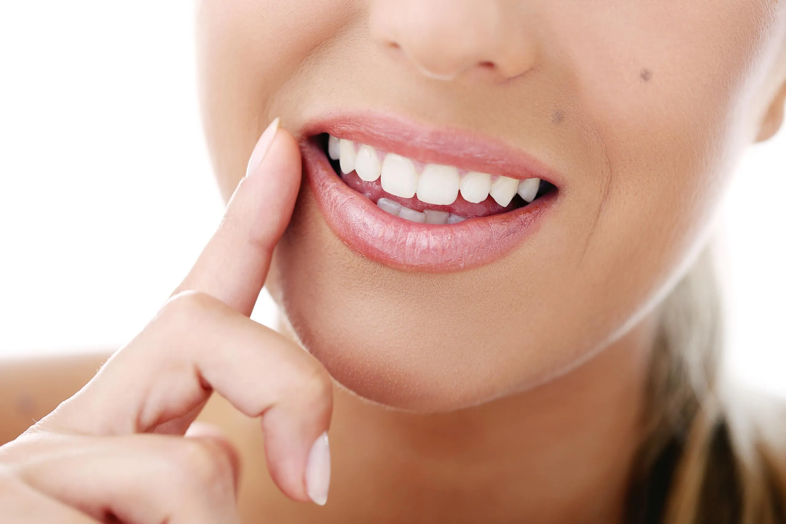 30115 teeth whitening Newcastle 5