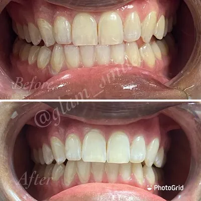 30117 regular dental checkup