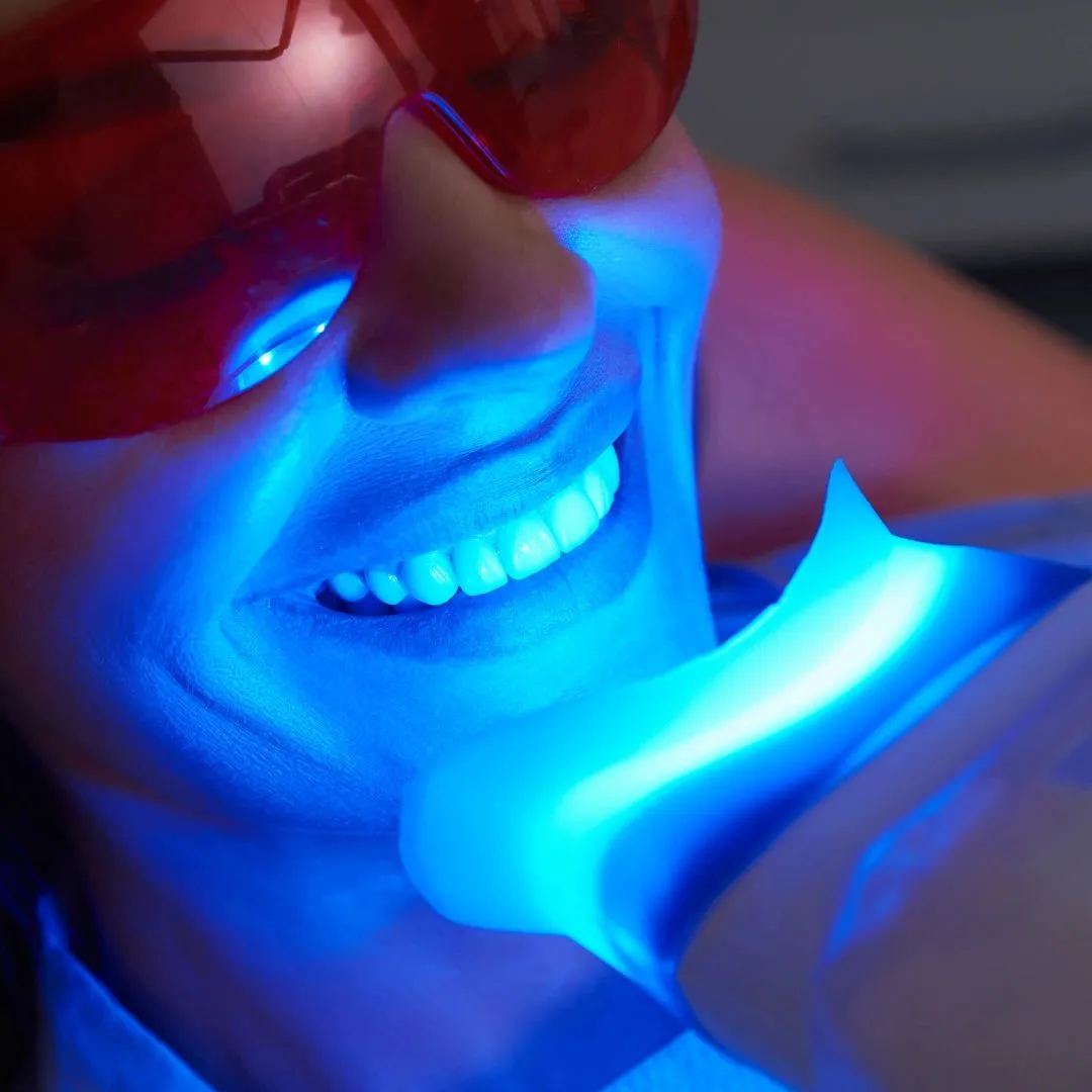 30119 teeth whitening memphis tn 6