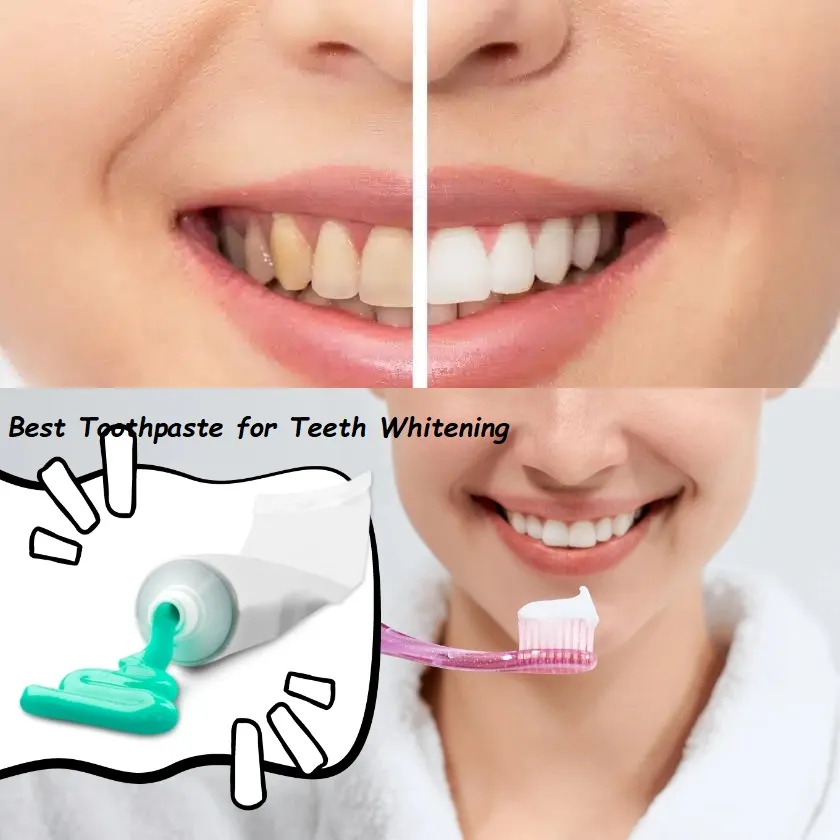 30121 whitening toothpaste brands
