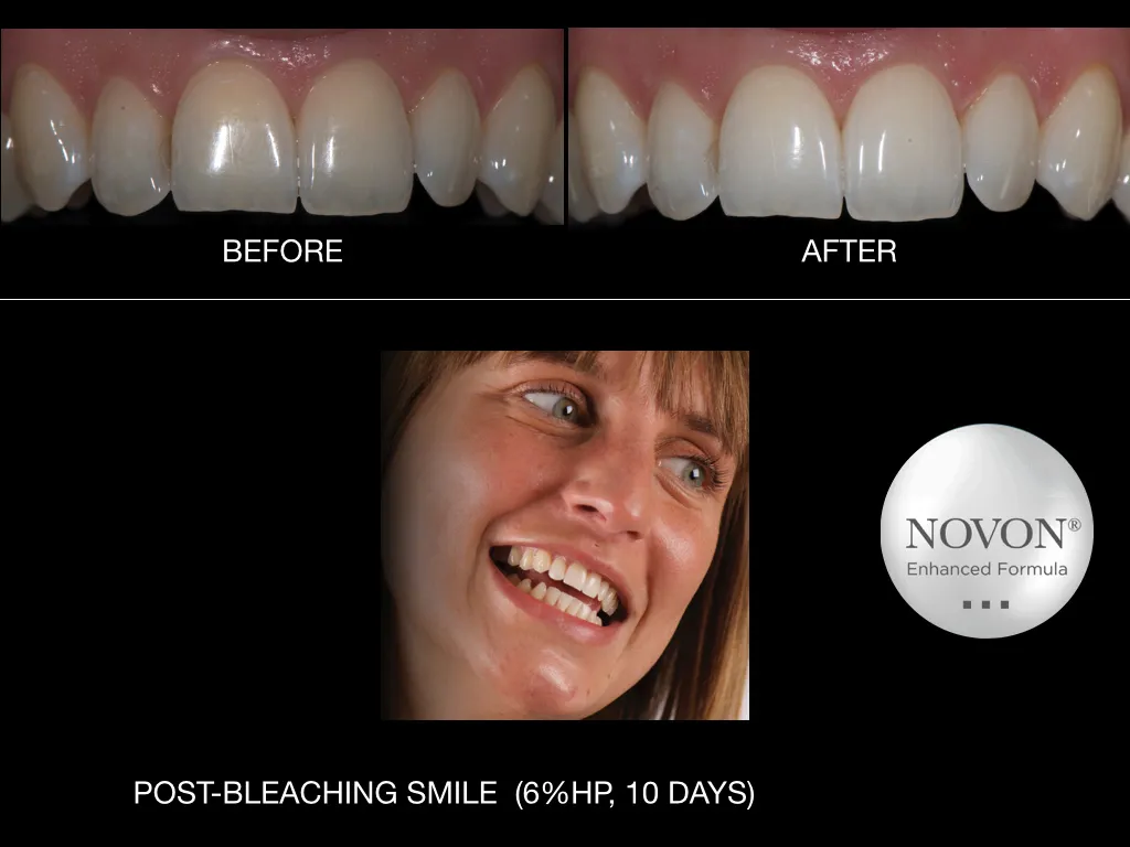 30128 healthy teeth smile