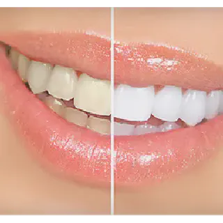 /img/30129-teeth-whitening-daytona-beach-provider-search.webp