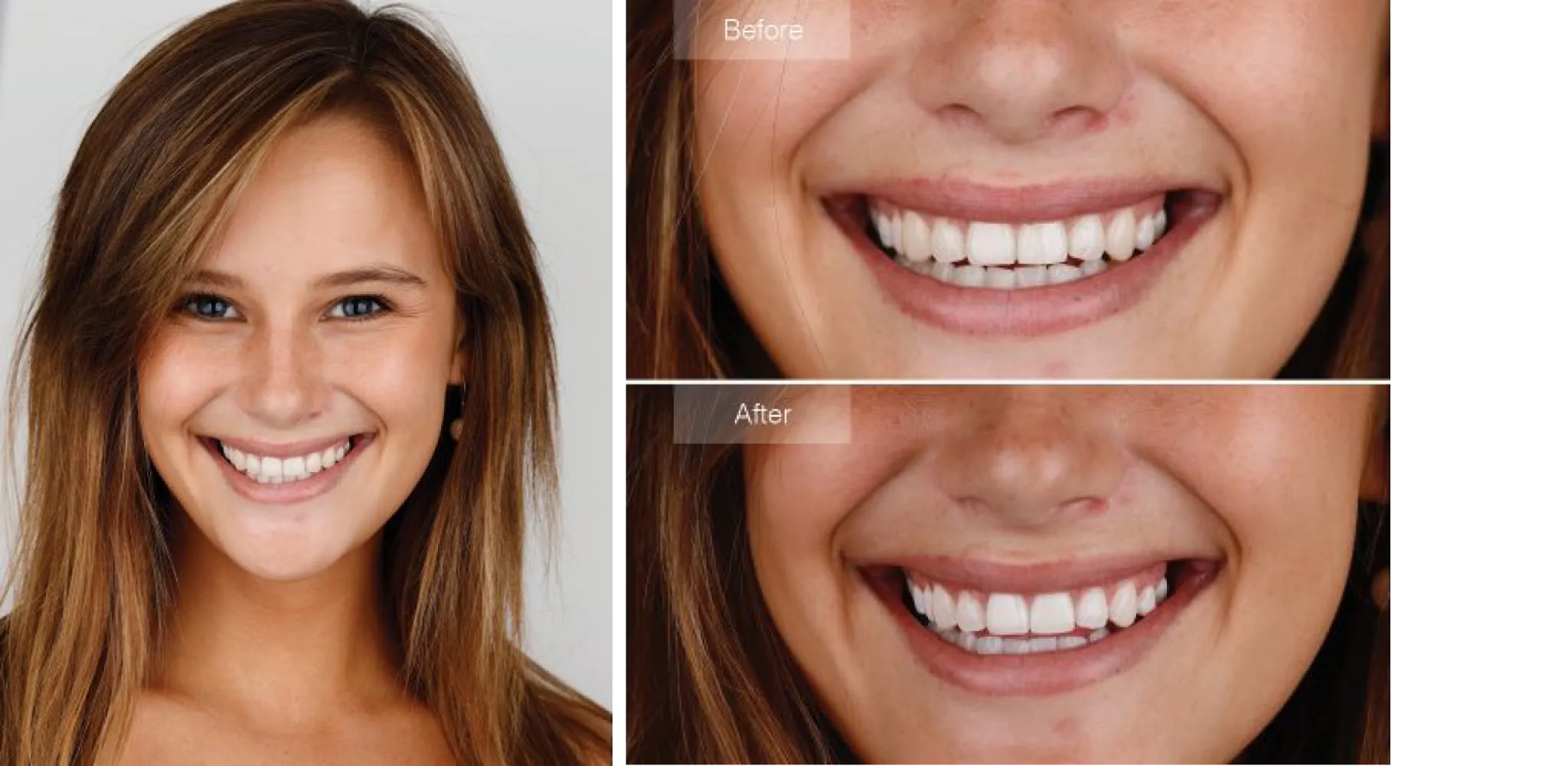 30141 types of stains