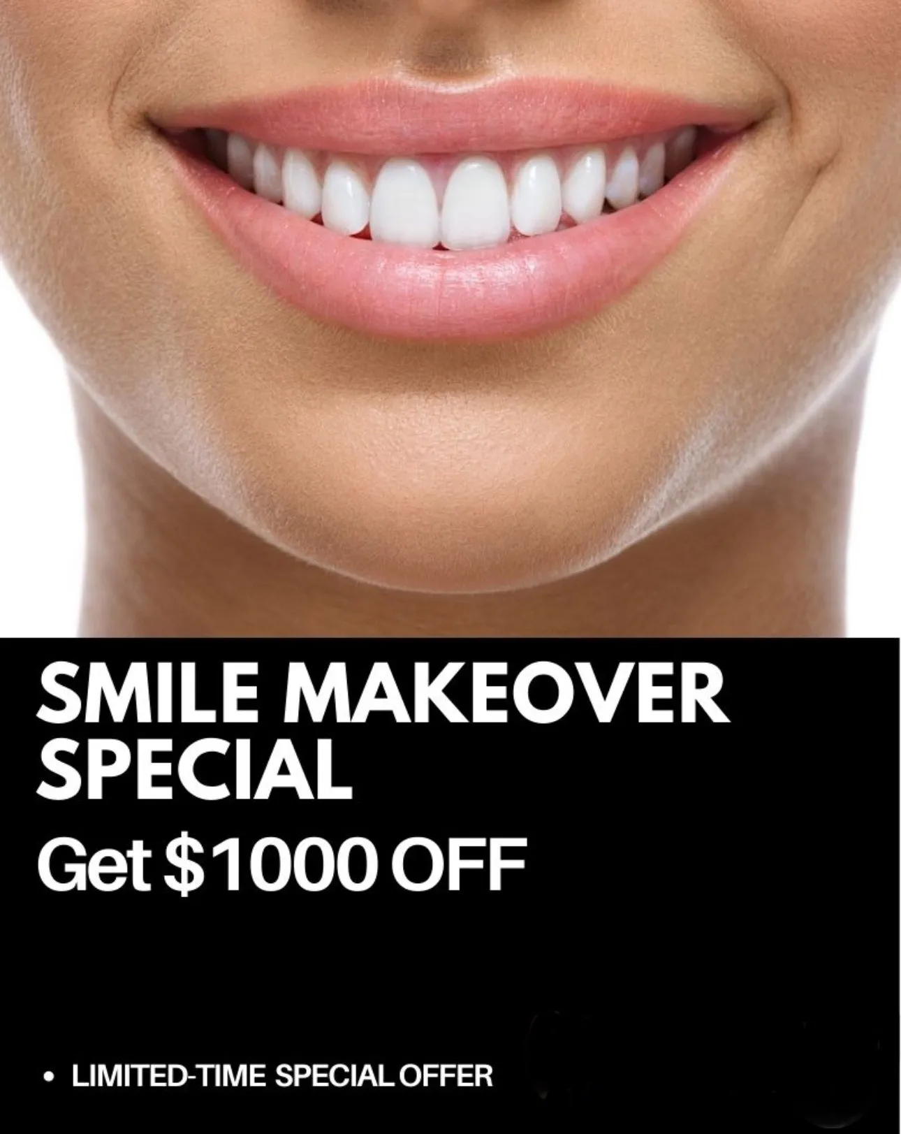 30144 teeth whitening options