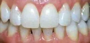 30149 brushing and flossing