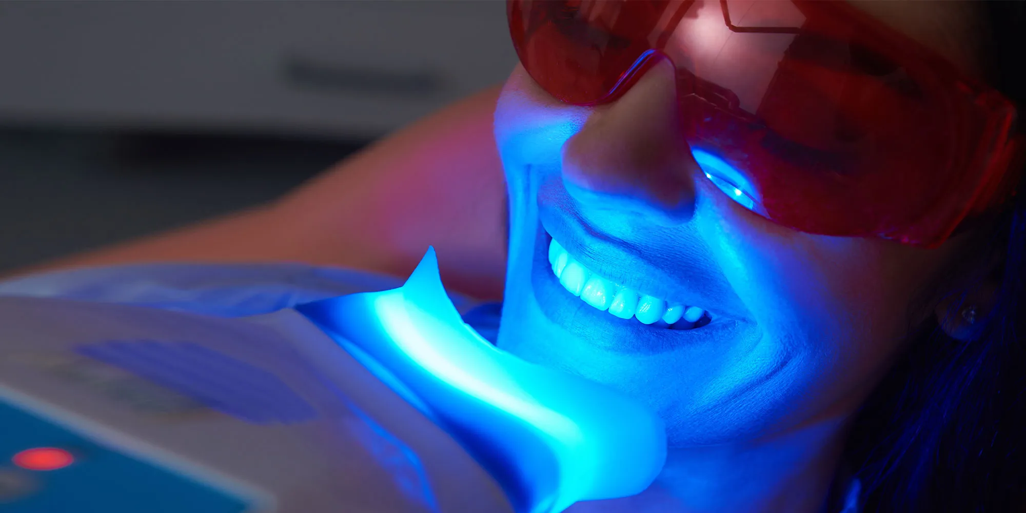 30149 professional teeth whitening