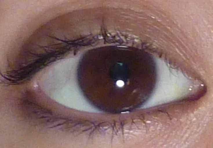 30151 eye whitening candidate