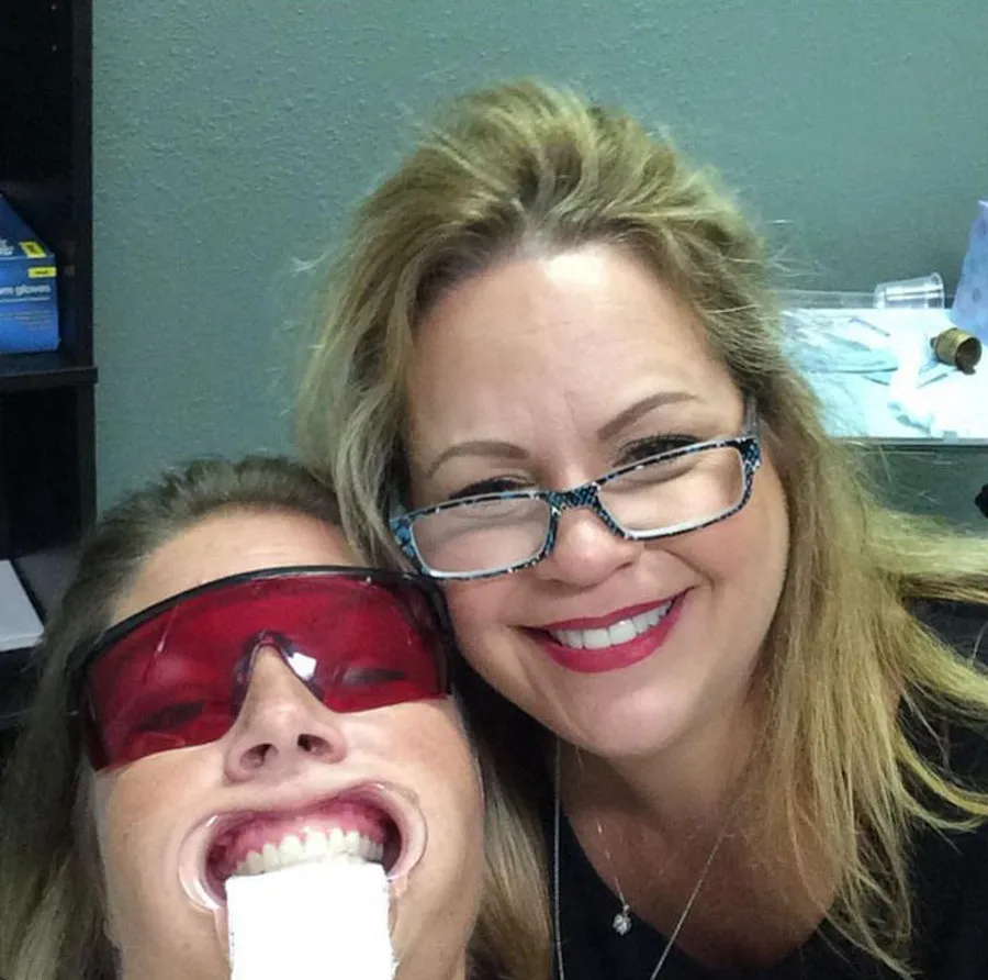 30155 maui whitening canfield results