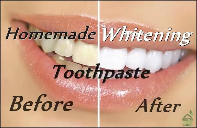 30166 baking soda lemon toothpaste
