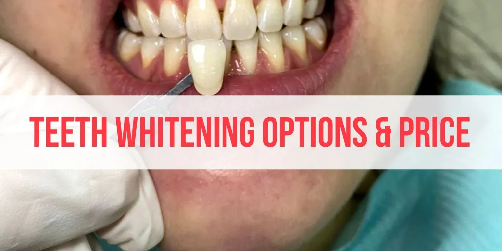 30174 teeth whitening malaysia